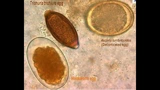 parasites seen from the microscope [upl. by Evette]