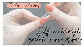 GELLAK VERWIJDEREN  Uitgebreide uitleg  Gellak Nederland [upl. by Anilac647]