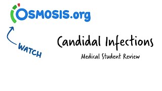 Candidal Infections Osmosis Study Video [upl. by Power]