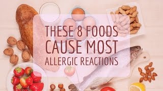 Food Allergy Causes Signs and Symptoms Diagnosis and Treatment [upl. by Lee]