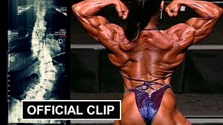 The Truth About My Back Pro female bodybuilder Denise Masino tells how she deals with Scoliosis [upl. by Gesner]