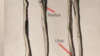 One Minute Anatomy A Difference Between the TibiaFibula amp RadiusUlna [upl. by Telrats]