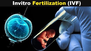 How Test Tube Babies Are produced  Invitro Fertilization UrduHindi [upl. by Annaej]