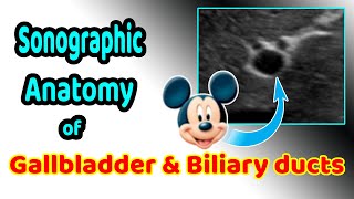 Sonographic anatomy of the gallbladder and biliary ducts [upl. by Eahsram]