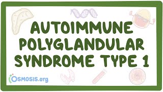 Autoimmune polyglandular syndrome type 1 [upl. by Langan]