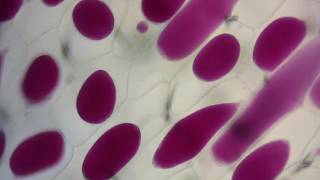 Red onion cell plasmolysis and its reversal [upl. by Ormiston879]