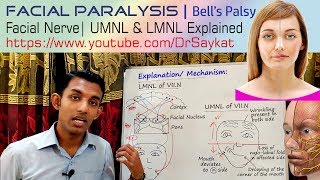 Signs And Symptoms Of Bells Palsy [upl. by Einnoj]