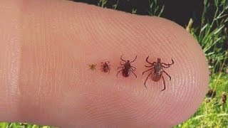 Doctor explains what you should know about ticks [upl. by Kulsrud]