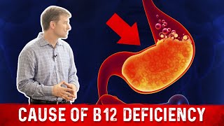 Vitamin B12 Deficiency The most common Cause – Dr Berg [upl. by Akinod]